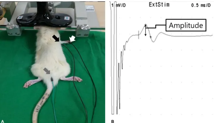 Figure 2. Active (black arrow), reference (white arrow), ground (gray arrow) electrode and the coil position (A) and the  representative motor evoked potential (B).