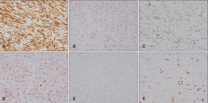 Table 1. Clinicopathologic features of previously reported cases of primary cutaneous SFTs Reference Sex/age 