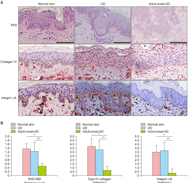 Fig. 2. Differences in basement membrane (BM) thickness and expression of type IV collagen and integrin α6 in normal skin, urticarial  dermatitis (UD), and adult-onset atopic dermatitis (AD)