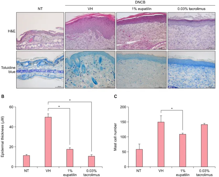 Fig. 3. (A) Histological features of atopic dermatitis (AD)-like skin lesions after treatment with 1% eupatilin