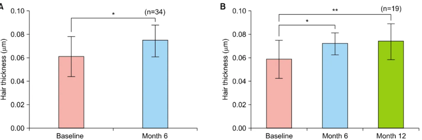 Fig. 2. Changes in hair thickness as assessed by phototrichogram analysis after 6 months and 12 months of treatment