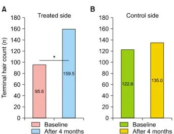 Fig. 3. Comparison of the mean terminal hair count on the (A)  treated and (B) control side of the scalp