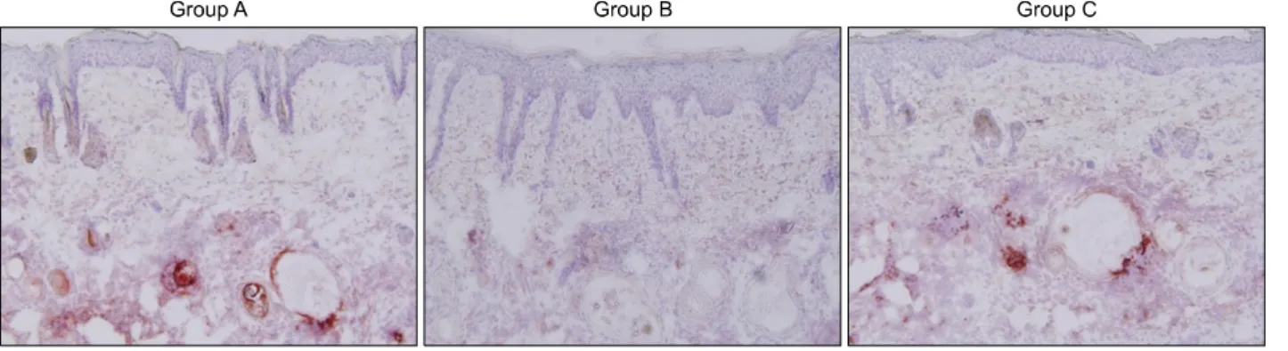 Fig. 5. Interleukin-1β expression decreased in group B and group C compared to that in group A.