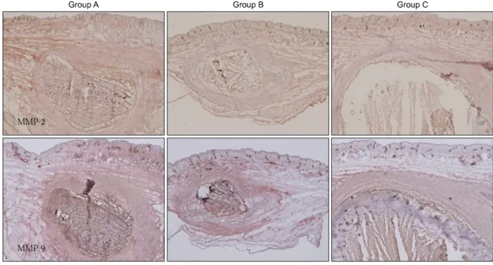 Fig. 6. Matrix metalloproteinase (MMP)-2 and MMP-9 expression decreased greatly in group B and group C compared to that in  group A.
