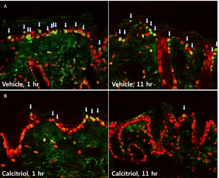Fig. 4. Immunofluorescence detection of cyclobutane pyrimidine dimer (CPD) at 1 and 11 hours after ultraviolet-exposure