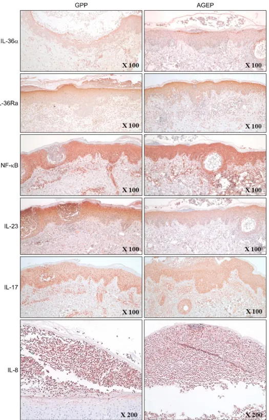 Fig. 1. The expression of cytokines  and its receptor in GPP and AGEP. 