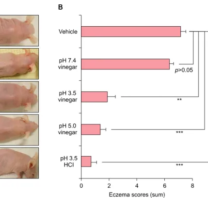 Fig. 1. (A) Oxazolone-treated atopic  dermatitis (Ox-AD) mice groups  treated with pH 3.5 vinegar cream,  pH 5.0 vinegar cream, or pH 3.5  hydrogen chloride (HCl) cream  exhibited fewer AD-like lesions  than mice treated with only vehicle  cream (pH 5.5) o