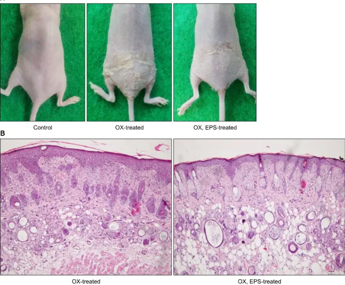 Fig. 1. Oxazolone (OX)-induced inflammatory changes in mouse skin are suppressed by application of 5% ethanol extract of peanut  sprouts (EPS)
