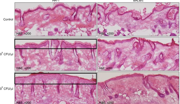 Fig. 2. Injected HR-1 mice exhibited significantly greater epidermal thickening than BALB/c mice