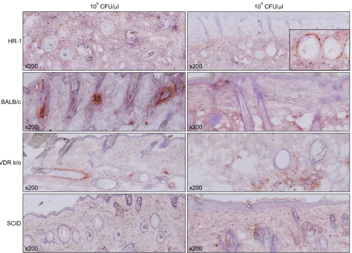 Fig. 5. Injected HR-1 and BALB/c mice exhibited higher toll-like receptor-2 expression in the epidermis than VDR k/o and SCID  mice (staining method: H&amp;E)