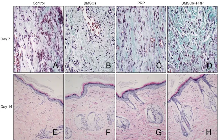 Fig. 3. Masson’s trichrome staining (A∼D: ×40) and H&amp;E staining (E∼H: ×20) of wounded skin sections