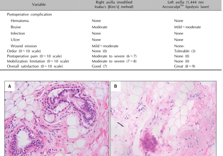 Fig. 3. Histologic examinations were done on the laser-irradiated area immediately post procedure and 6 months after the procedure  (H&amp;E, ×200)