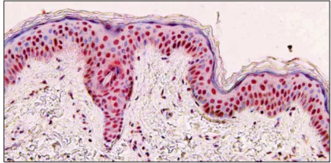 Fig. 1. Cold-inducible RNA-binding protein (CIRP) expression is  evident in the nuclei of epidermal keratinocytes in normal skin  from back (CIRP immunohistochemical stain, ×200).