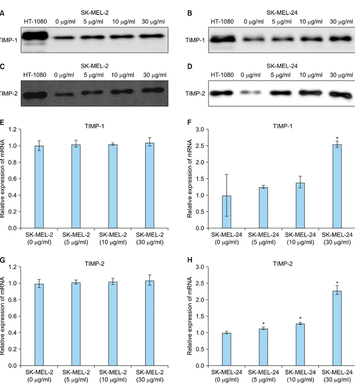 Fig. 5. Expression of tissue inhibitors of metalloproteinase (TIMP)-1 and -2 protein and mRNA in SK-MEL-2 and SK-MEL-24 cell lines  following incubation with imiquimod