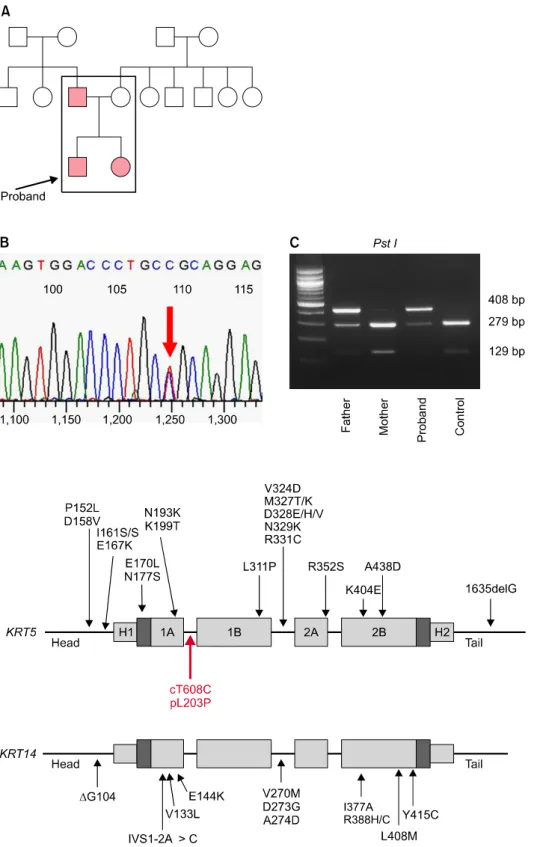 Fig. 4. Schematic representation of  the mutation sites on keratin 5 and  14 in Weber-Cockayne type  epider-molysis bullosa simplex from  litera-ture and this case.