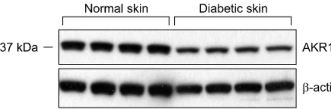 Fig. 1. AKR1C3 protein was expressed on normal skin tissue, diabetic skin tissue by western blot analysis