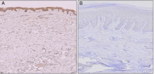 Fig. 2. The median of normal skin tissues was 0.935 (interquartile range, 0.911 to 0.973), and the median of diabetic skin tissues was 0.698 (interquartile range, 0.671 to 0.781)