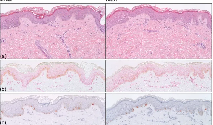 Fig. 2. Histological findings. (a) There were no remarkable findings on H&amp;E staining