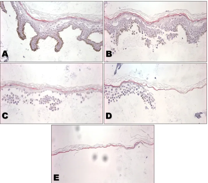 Fig. 1. Histologic analysis of an epidermal sample. (A) A H&amp;E stained section of the entire epidermis after thermolysin incubation  and removal of the dermis