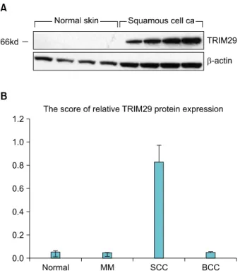 Fig. 1. (A) TRIM29 protein was expressed on squamous cell carci- carci-nomal, normal skin tissue  by western blot analysis