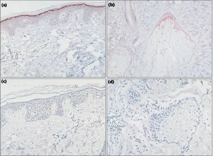 Fig. 5. Immunohistochemical staining of toll-like receptor (TLR)-2 in patient 3 (×400)