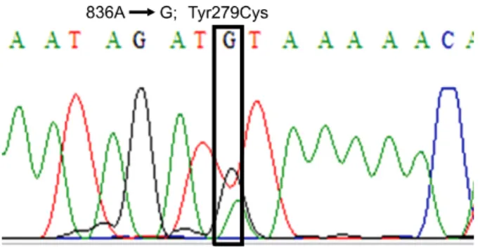Fig. 5. Mutation analysis of PTPN11 gene revealed a missense mutation 836A→G in exon 7.
