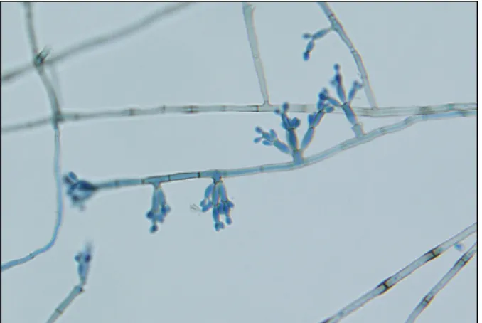 Fig. 5. Elliptical, brownish conidia from conidophore were seen in the slide culture of F