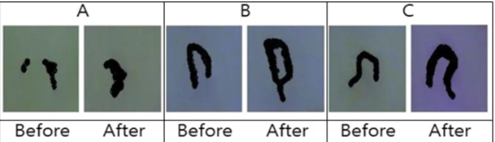 Fig. 1. Changes on blood circulation in human capillary of according to consumption of π-ray treated broiler breast meat of broiler.