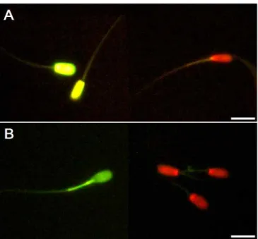 Fig. 1. Sperm viability was measured by SYBR-14/propidium iodide double staining assay (A), and mitochondrial membraene activity was analyzed using rhodamin123/propidium iodide double staining assay (B)