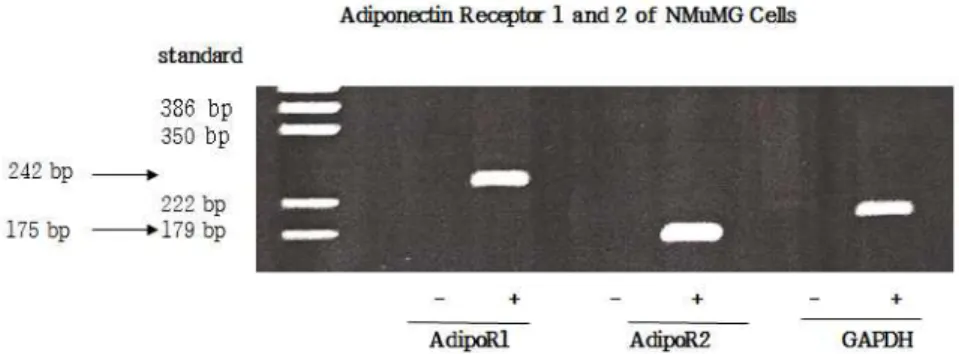 Fig. 1. RT-PCR analysis of adiponectin receptor 1 (AdipoR1) and receptor 2 (AdipoR2) expression