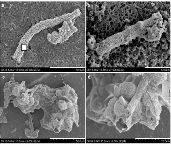 Fig. 5. SEM image for the sheathed-filament structures and the spherical granule structure in the yellow-colored iron  hydroxide