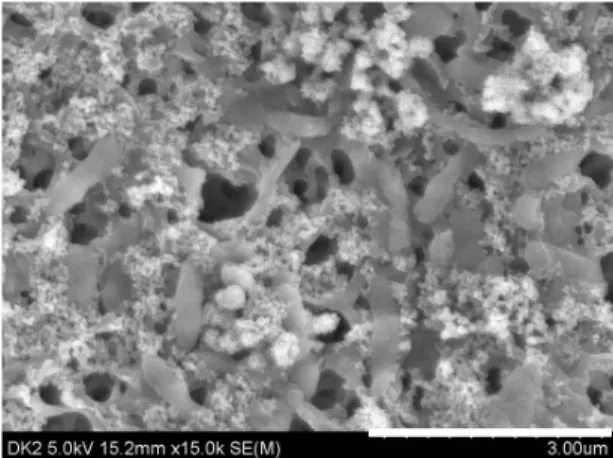 Fig. 6. SEM image of the rod-shaped bacteria in the mine  drainage at DK2 (oxidation pond)