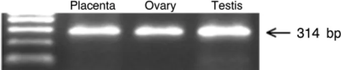 Fig.  1.  Ideogram  of  bovine  Oct-4  cDNA  for  RT-PCR 4.  면역조직  염색법(immunohistochemistry)     10％  formalin에 고정 되어진 태반(평균 임신기간 283±3 일)분만, 난소,  정소 조직을 5  ㎛의 두께로 자르기 위하여 파 라핀을 블록화 한 후,  조직 내 핵을 보기 위한 hematoxylin  염색과 세포질을 eosin으로 염색해 immunostaining  결과와 