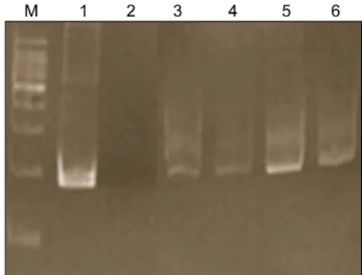 Fig. 3. Positive CD 30 immunostai- immunostai-ning of sections of both LyP (A) and  ALCL (B) (×40).