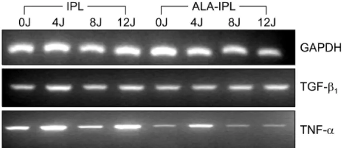 Table 4. IL-10 protein expression after IPL or ALA-IPL IPL energy (J/cm 2 )  x-fold induction IPL ALA-IPL 0 4 8 12 1  4.57±1.26  5.95±0.22* 2.28±0.87  2.08±0.43 2.28±0.29 2.04±0.33 2.85±0.58  Data represent mean±SEM from triplicate determinations of at  le