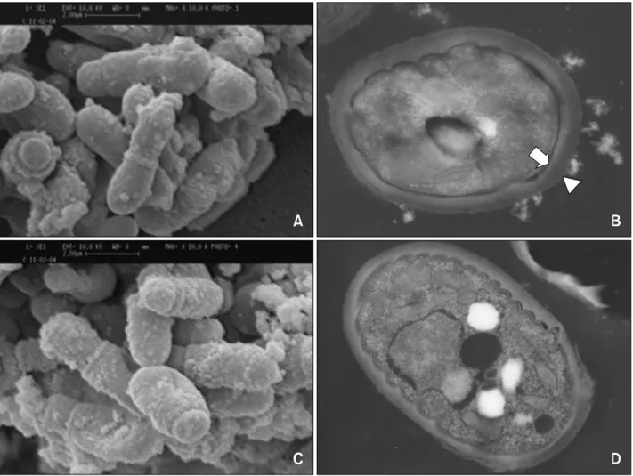 Fig. 2. Scanning and transmission electron microscopic findings of the detergent-untreated and tween-80 treated M