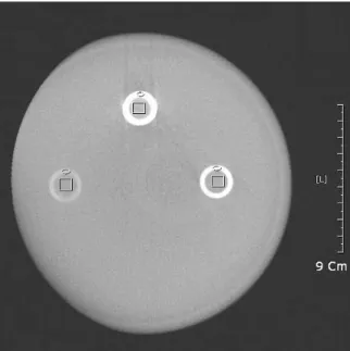 Fig. 1. Measuring the density of three materials (aluminum (top), Teflon-PFA (Perfluoroalkoxy) (right one of bottom row), and acetal (Polyoxymethylene plastic) (left one of bottom row)) for a surgical stent on CBCT image.