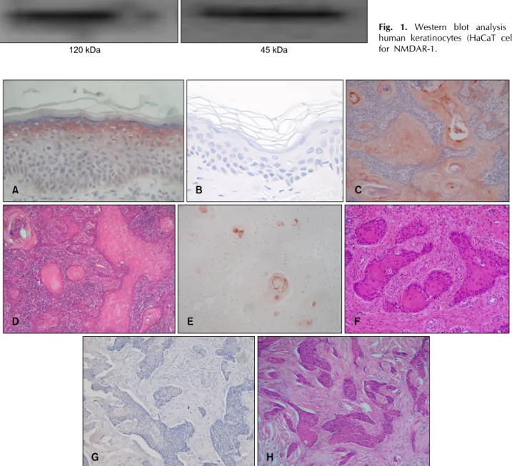 Fig. 1. Western blot analysis of  human keratinocytes (HaCaT cells)  for NMDAR-1.