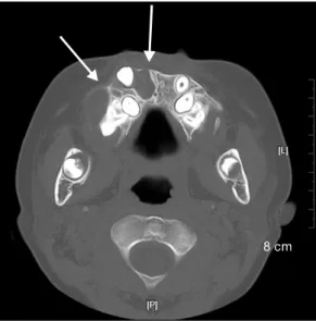 Fig.  2.  Pigmented  macules  were  identified  on  the  palmar  skin  surface  of  the  right  hand.
