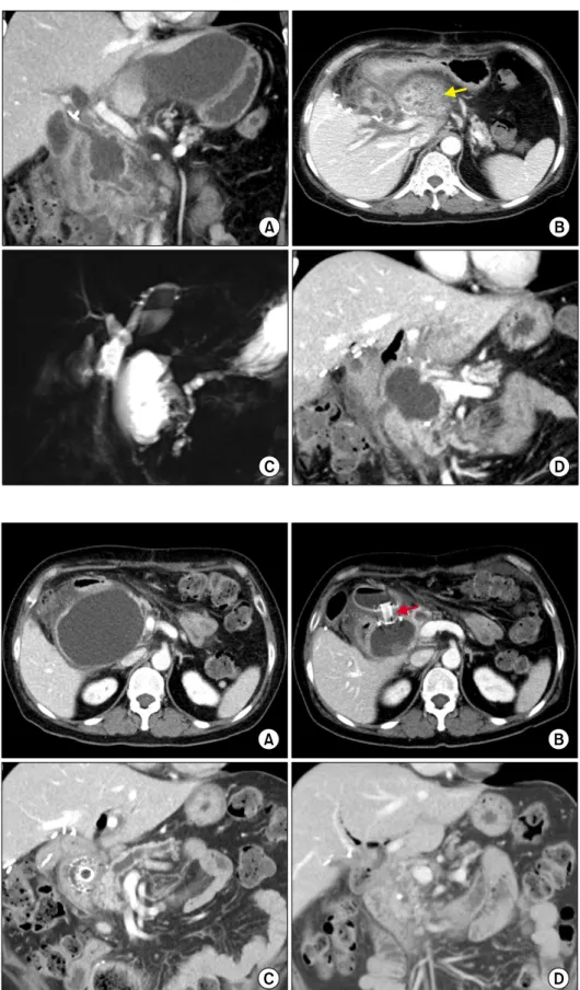Fig. 5. Postoperative computed  tomography (CT) and magnetic  resonance imaging findings