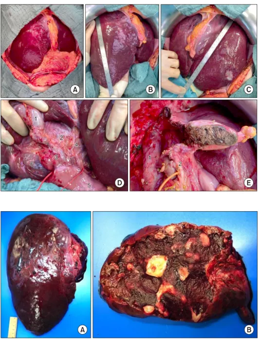 Fig. 5. Pathological findings. 