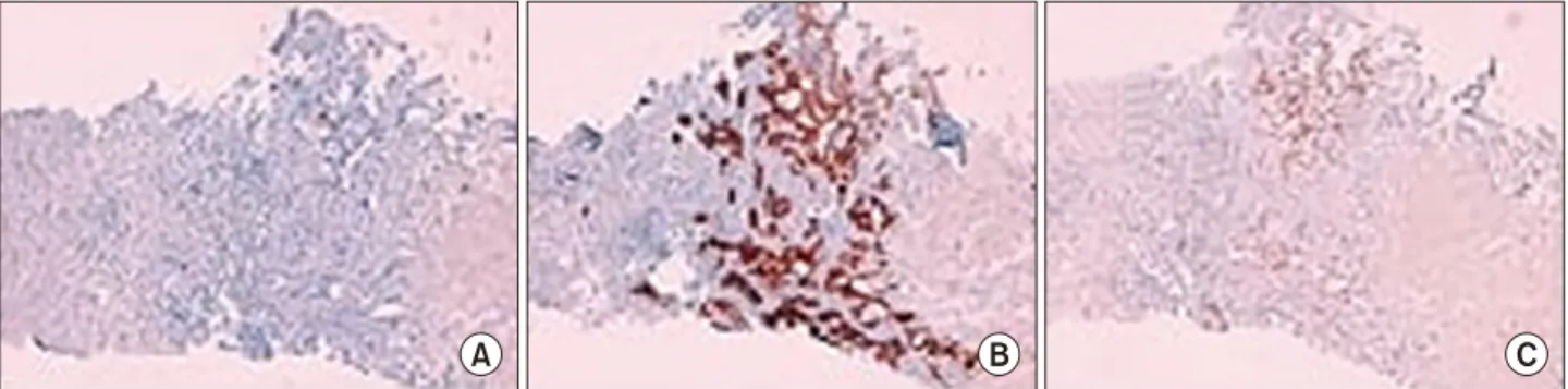 Fig. 3. (A) CDK7+, (B) CDK20‒, (C) CDX2+.