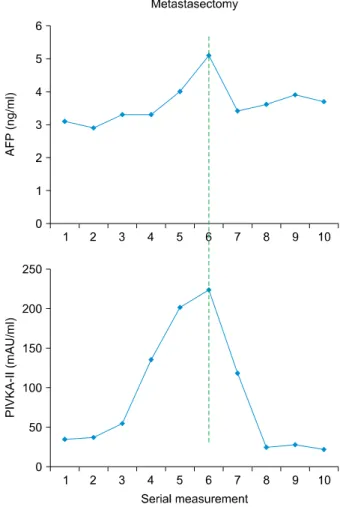 Fig. 3. Positron emission tomography analysis of Case 1  showing a mass with hypermetabolic uptake (arrow).