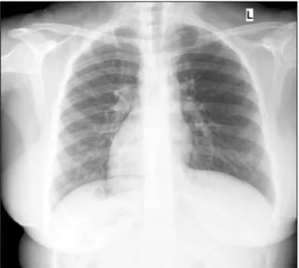 Fig. 3. Section of computed tomography scan showing re- re-versed positions of the viscera.