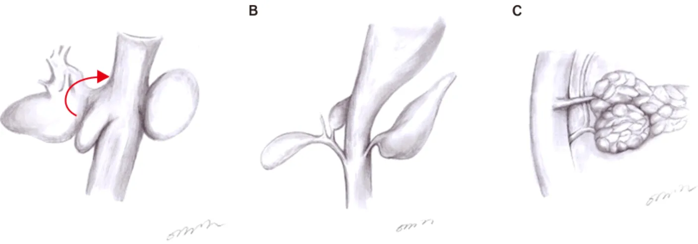 Fig. 5. Illustration of development of the pancreas during the embryonic period. Ventral and dorsal pancreas arise from the  digestive organs at the 4 th  week of gestation (A)