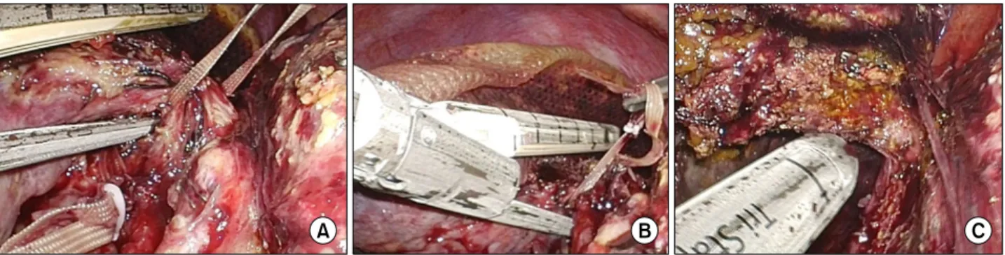 Fig. 5. Postoperative liver function.