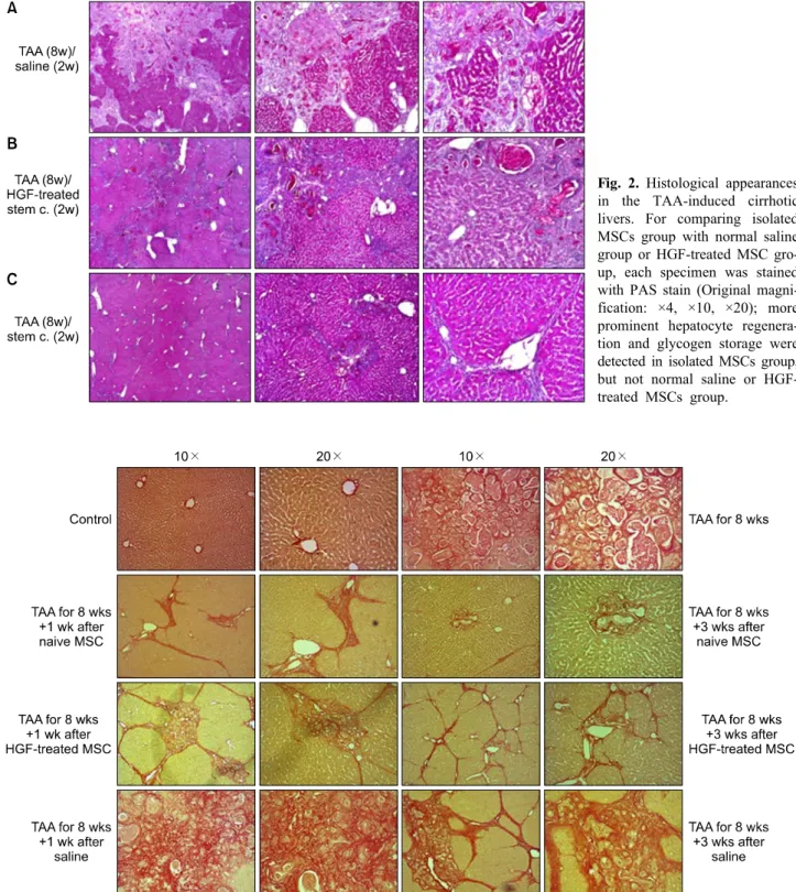 Fig. 2. Histological appearances  in the TAA-induced cirrhotic  livers. For comparing isolated  MSCs group with normal saline  group or HGF-treated MSC  gro-up, each specimen was stained  with PAS stain (Original  magni-fication: ×4, ×10, ×20); more  promi