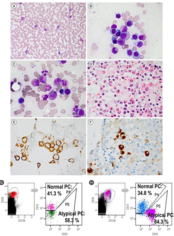 Fig. 1. Morphologic and IHC findings of PB and BM samples, and flow cytometric immunophenotyping of PC