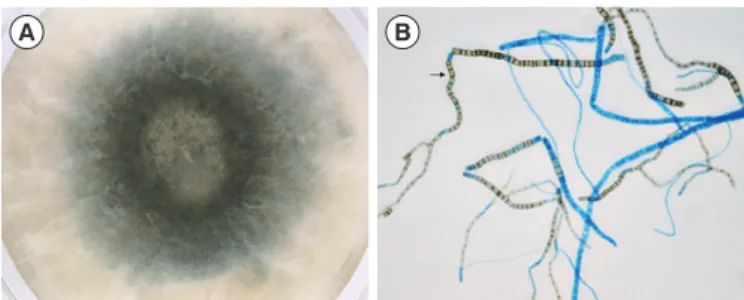 Fig. 1. Culture of the  Neoscytalidium dimidiatum brain isolate on  Sabouraud dextrose agar