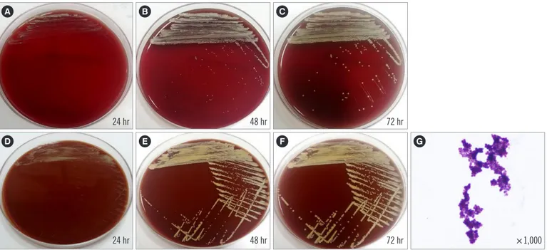 Fig. 1. Subculturing of the isolate on blood (A, B, C) and chocolate (D, E, F) agar plates